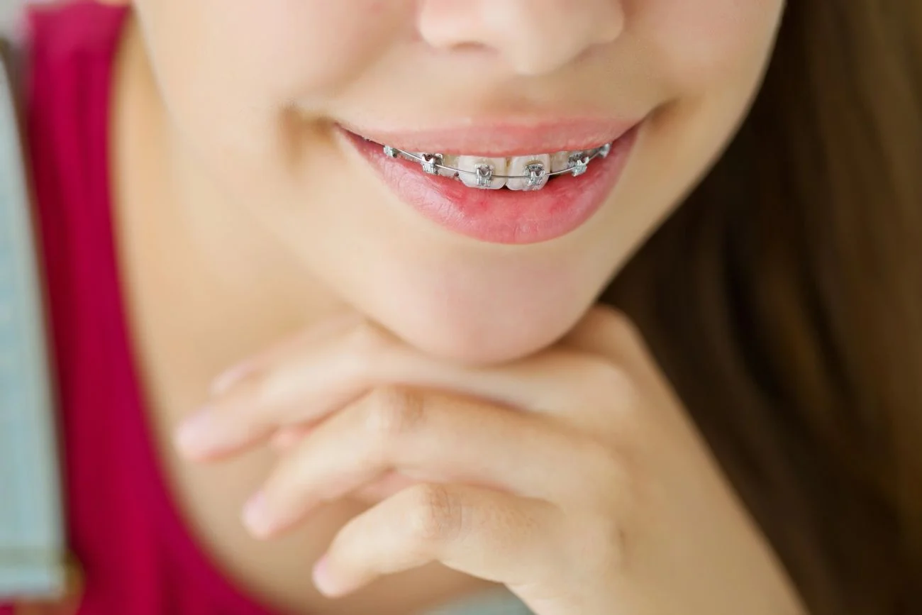 Wizyta u ortodonty – jak wygląda krok po kroku?